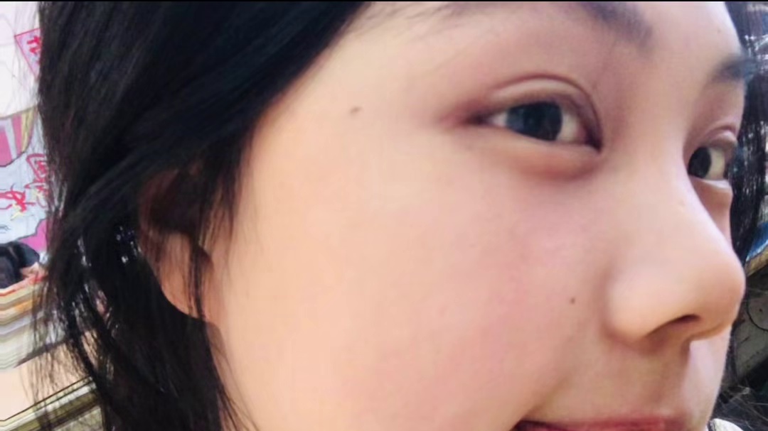 17岁的夏天          -被王者包围