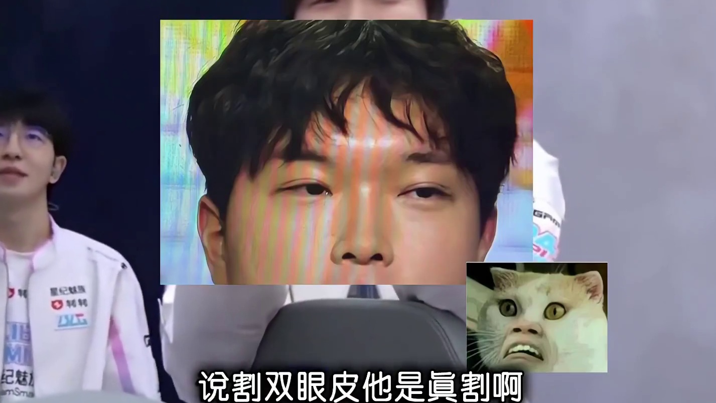 Bin哥真割了！双眼皮做完首次亮相，颜值大提升！