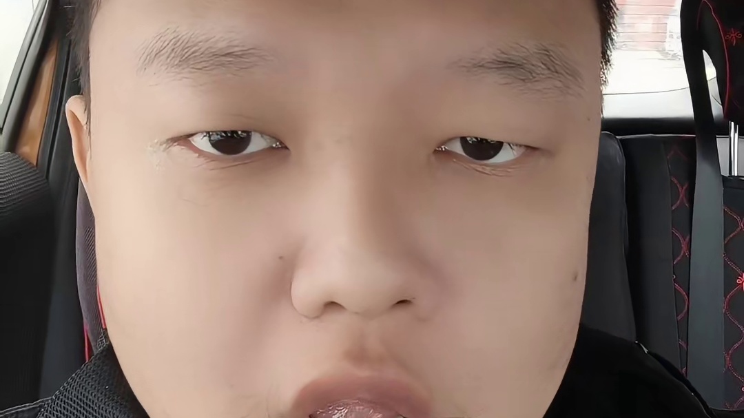 伤残鉴定避3坑！关系、时间、内固定全是套路