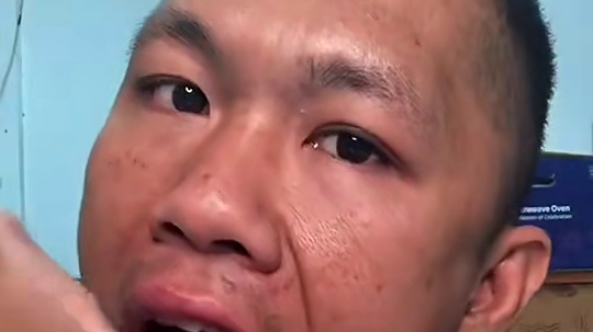 泰式臭鱼拌青芒果