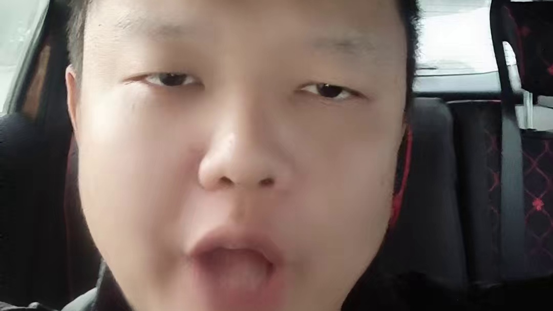 工伤内固定评级别瞎猜！这篇让你搞清九级工伤咋认定