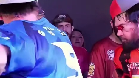 把脸打肿的见多了，直接打出血的见过吗？ #耳光大赛 #巴掌大赛 #格斗 #拳击