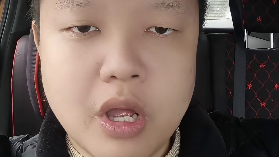 骨折≠评级！这3种骨折鉴定白费功夫，关乎你的职场权益