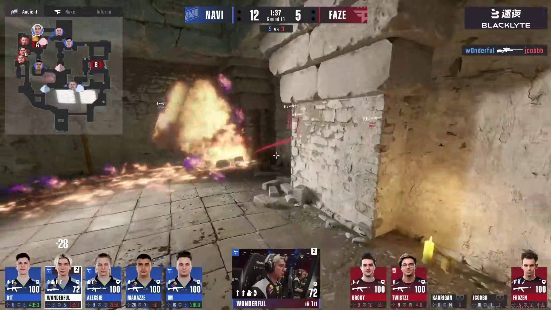 w0nderful疯狂repeek大狙三杀终结比赛！