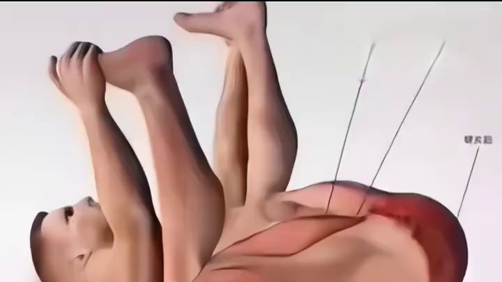 腰疼的时候我还没当回事。直到坐骨疼的时候我不得不注意身体了。