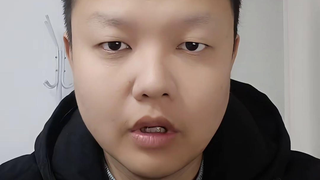 工伤谈判总被坑？三句话让公司乖乖赔钱！