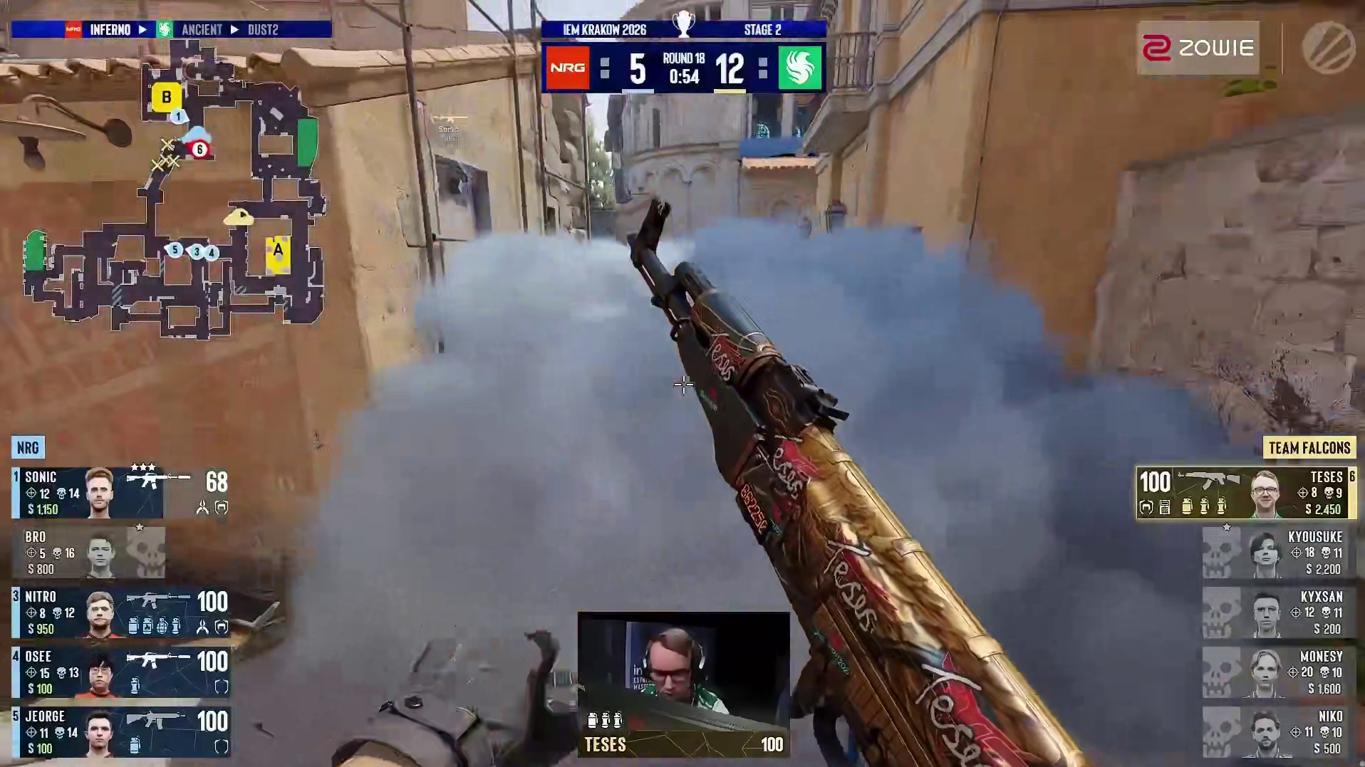 不可思议！TeSeS逆天1v4残局终结比赛！