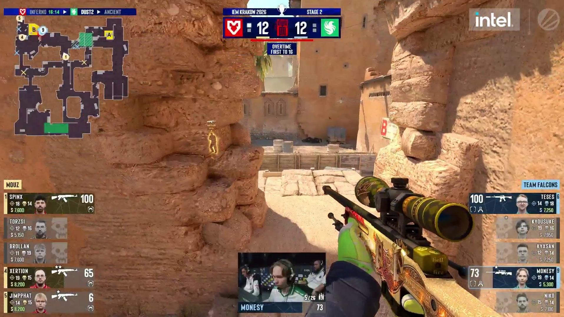 MOUZ 3v5惊天翻盘加时赛开门红！