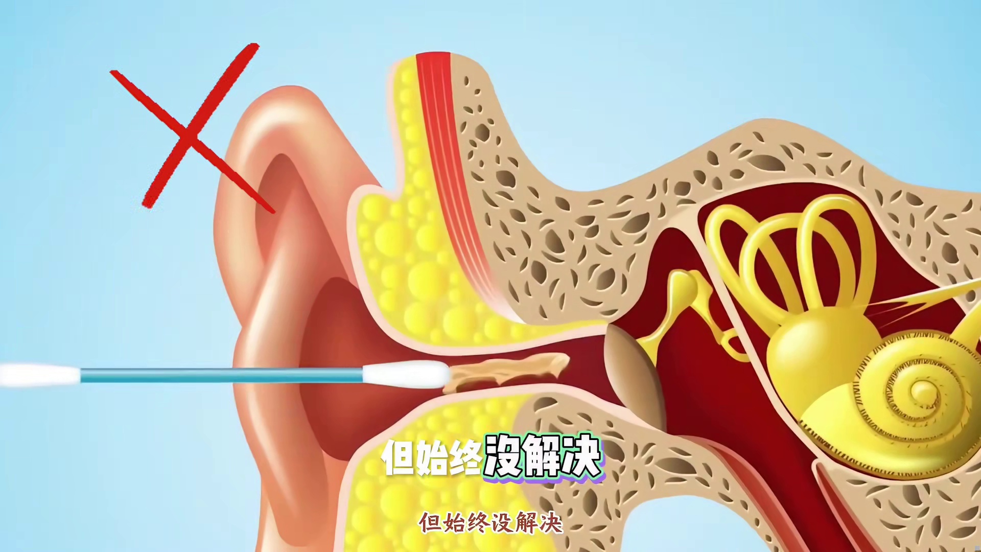 可视挖耳勺怎么选？爆品掏耳勺全解析，从入门到高端一步到位选对可视好物 闭眼入