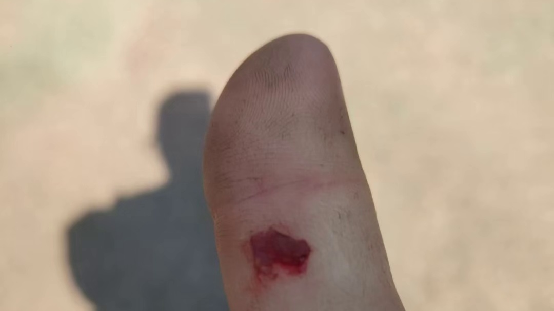 这就是今天偷懒的代价