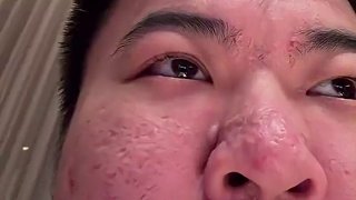抱怨鼻子臟咳出聲