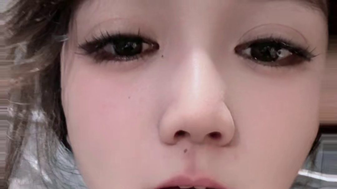我形容你是生命中的一道淤青