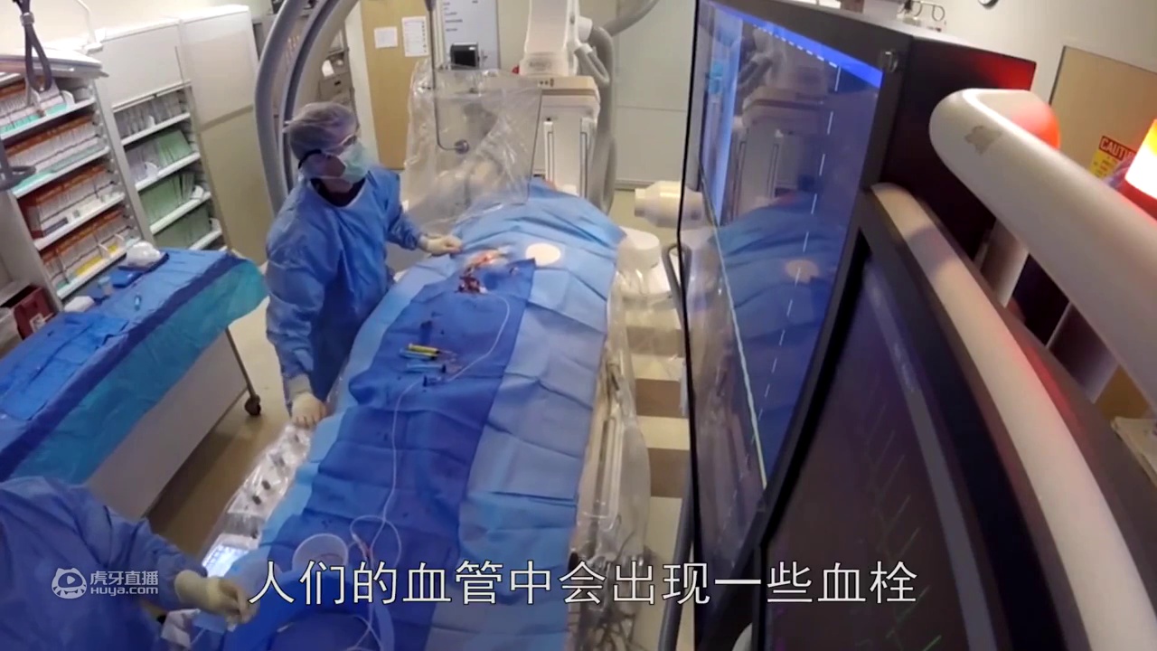 世界首款血栓切除系统，3d动画演示全程，清除迅速60秒拯救千万人