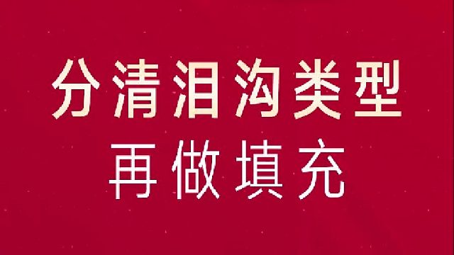 深圳艺星：分清泪沟类型再做填充