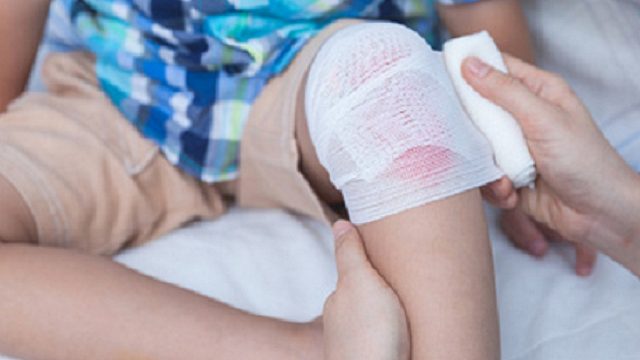 还来得及！只用40天去除疤痕！还孩子无暇肌肤！！！