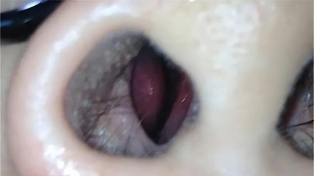 【热点聚焦】春季花粉过敏喷嚏狂打，水泥封鼻？三个妙招不妨一试