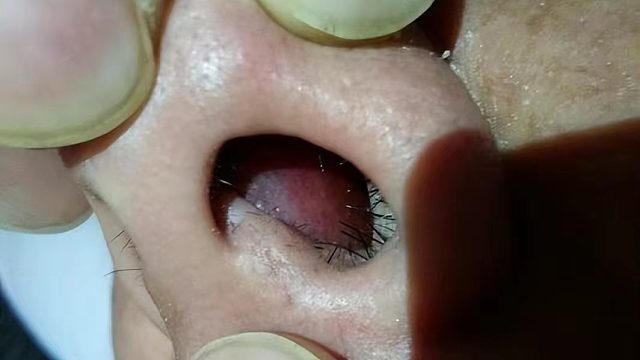 春季过敏性鼻炎频发？过来人三招教你应对！水泥封鼻退退退！