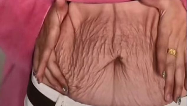 去除妊娠纹别乱花冤枉钱！这2个方法替大家试过了！真的管用！