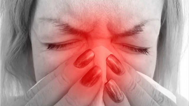 多年鼻炎康复经验大曝光！每天坚持3件事！再也不怕鼻炎复发！