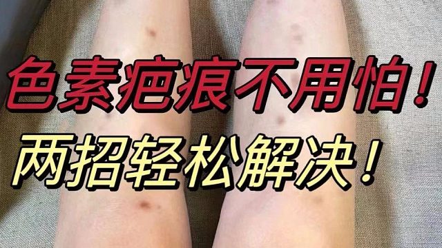 色素疤痕是如何形成的？修复它需要注意哪些点？