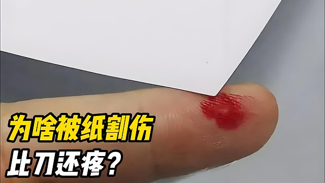 手指被纸割伤，为什么比被刀割伤还疼？看完明白