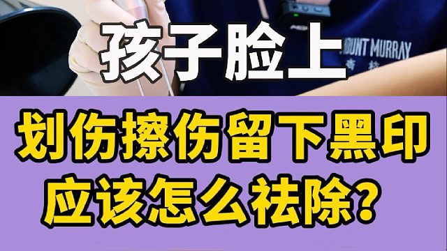 孩子擦伤后不想留下黑印可以这么做！宝妈一定要学