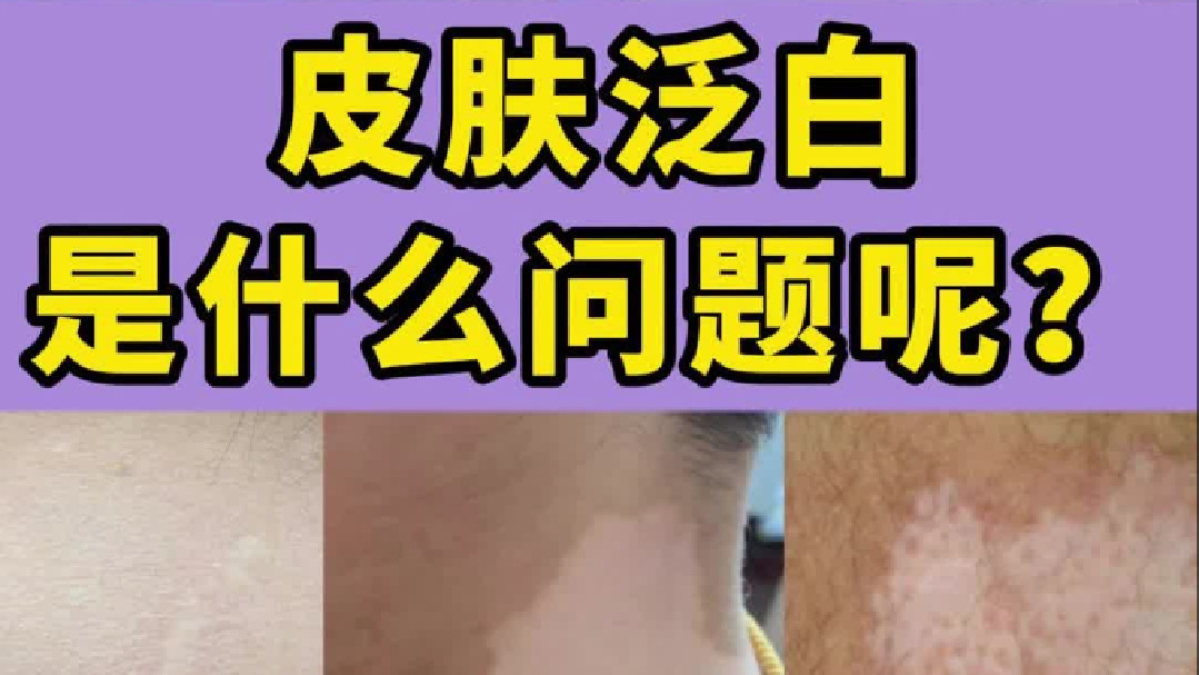 皮肤泛白，是什么问题呢？一个视频看懂！