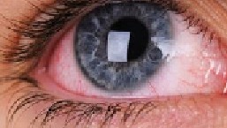 为什么说眼睛不能被身体发现？ 眼睛 免疫系统 科普一下