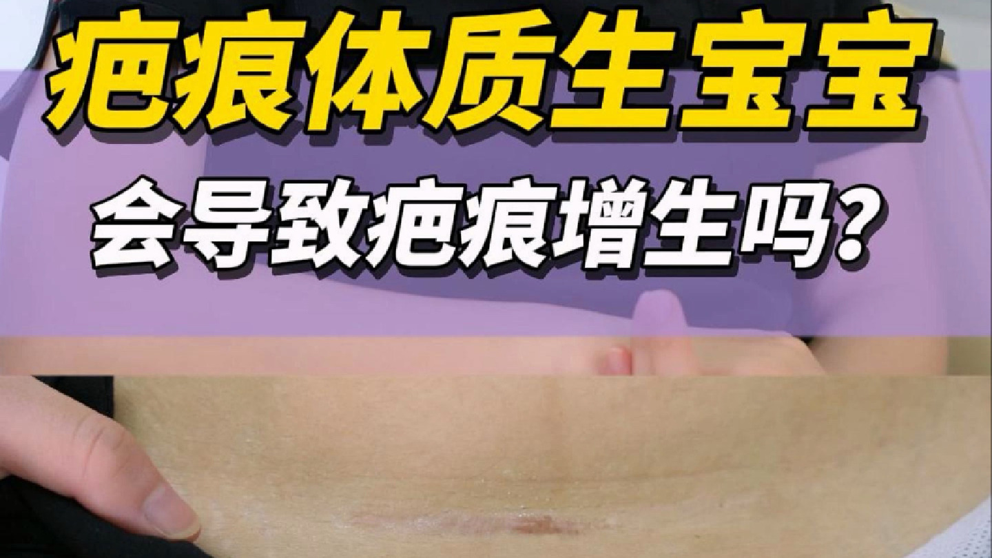 疤痕体质生宝宝，会不会疤痕增生？