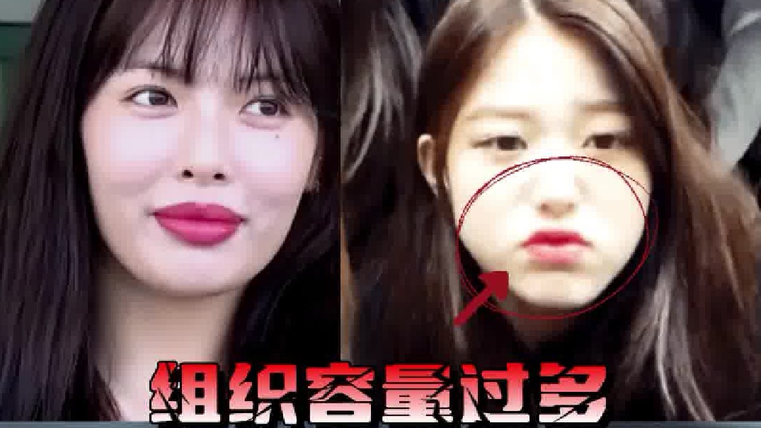 【口周年轻化】一条视频说清楚底层逻辑