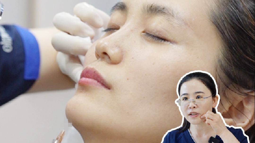 下巴填充有多疼？怕痛必看