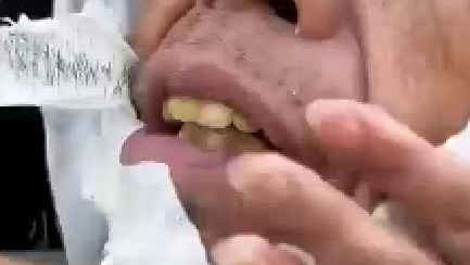 脱毛效果棒棒哒，老大爷哭了