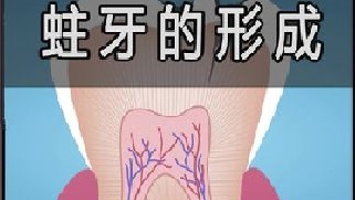 牙齿上的黑线，到底是怎么回事？