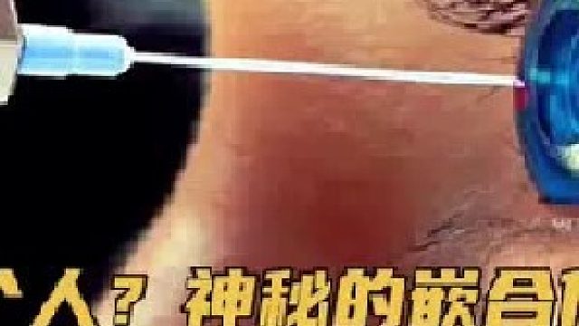 你体内还存在另一个自己？揭开神秘的“嵌合体”人（中）