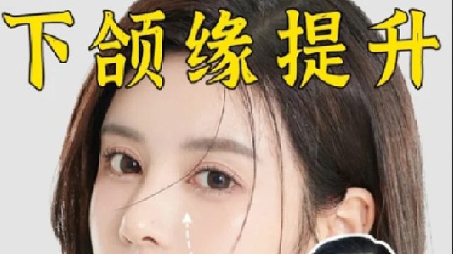 下颌缘提升，不同年龄抗衰思路