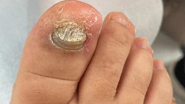 国内祛灰产品大测评！这些可别再买了，看看有没有你用的！