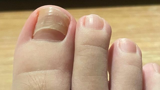 祛灰产品大测评！一个月坏甲唰唰掉！看看有没有你用的！