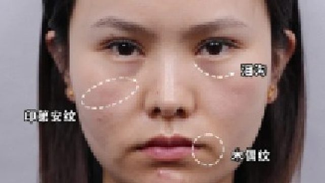 哭了，肉肉脸花期真的太短了