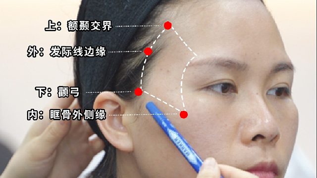 太阳穴填充思路｜小剂量打造头包脸