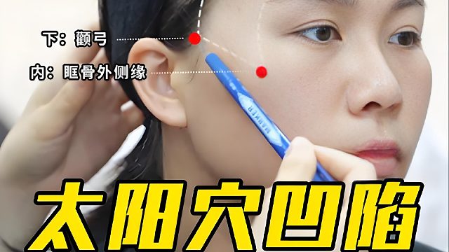 太阳穴凹陷调整思路，小剂量打造头包脸