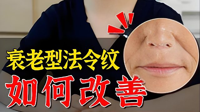 衰老型法令纹，怎么填不移位？