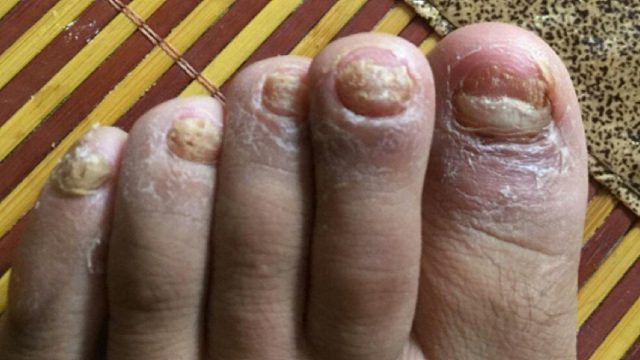 有什么好用的祛灰药推荐吗？过来人亲测分享！