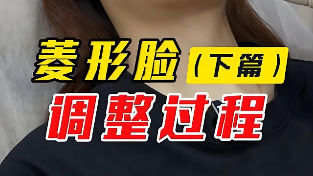 菱形脸调整过程，小剂量改善外轮廓