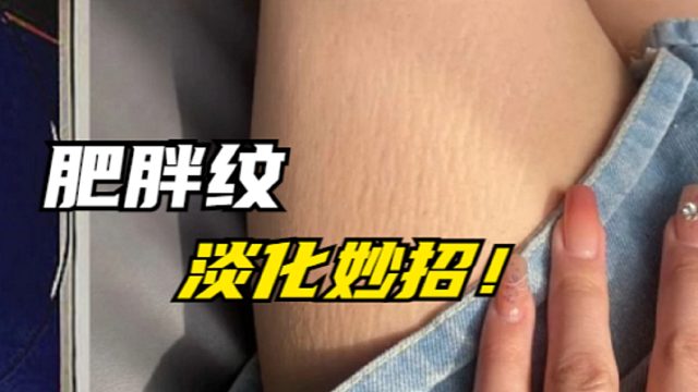 肥胖纹变白还有救吗？学会这个步骤，一个月皮肤重回光滑细腻！