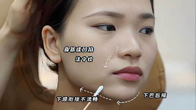 眼周年轻化调整思路，小剂量改善疲惫感