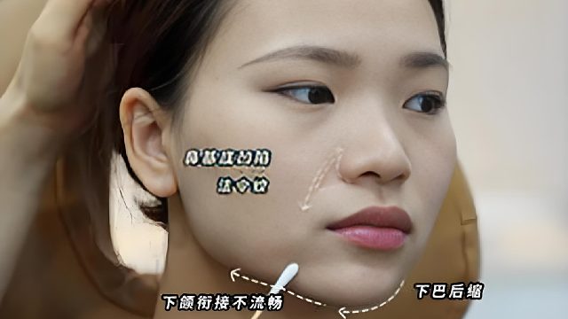 口周年轻化调整思路，小剂量改善骨性