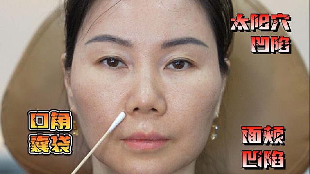 轮廓不流畅 口周年轻化 调整思路