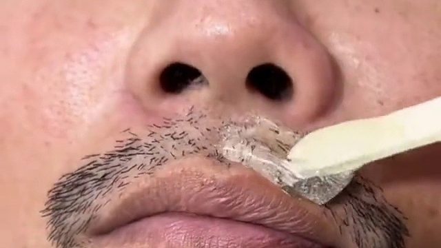 费那事…直接《葵花宝典》，一次性解决