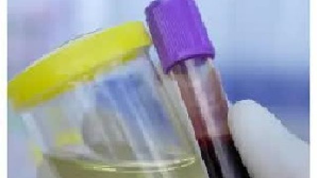 运动员一年要检测多少次兴奋剂？