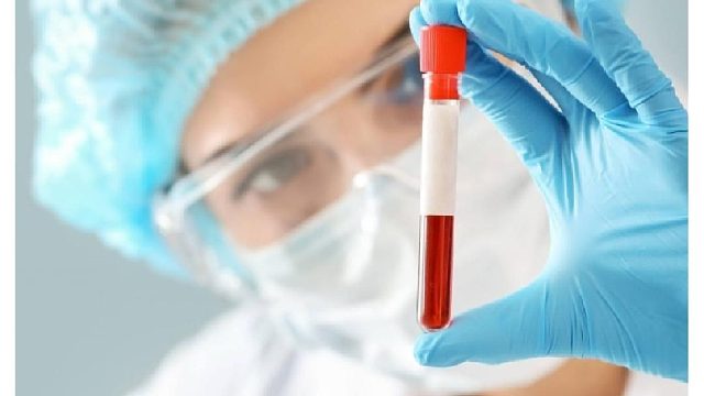 射箭 需要检查兴奋剂吗？